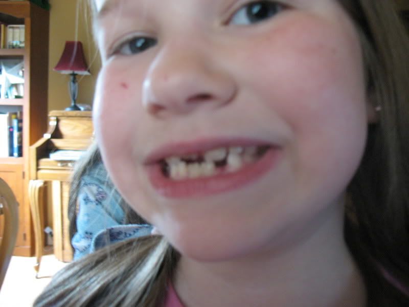 JUNE2009003.jpg Judith's lost tooth picture by kaysmarmey