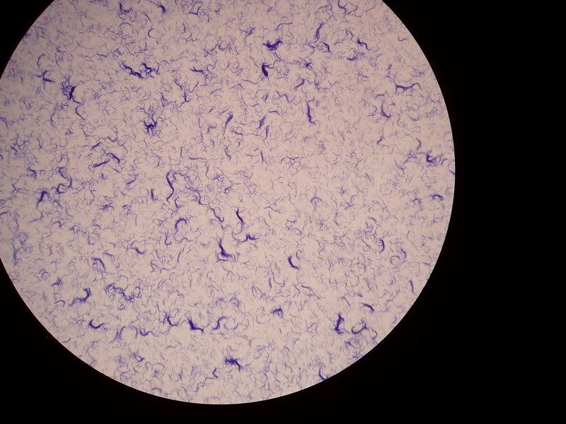 bacillus spore stain