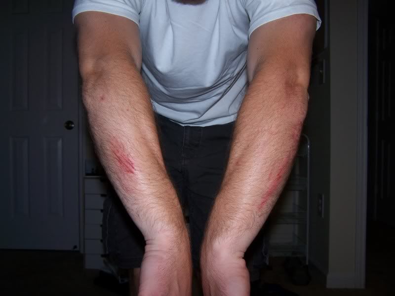 [Image: arm.jpg]